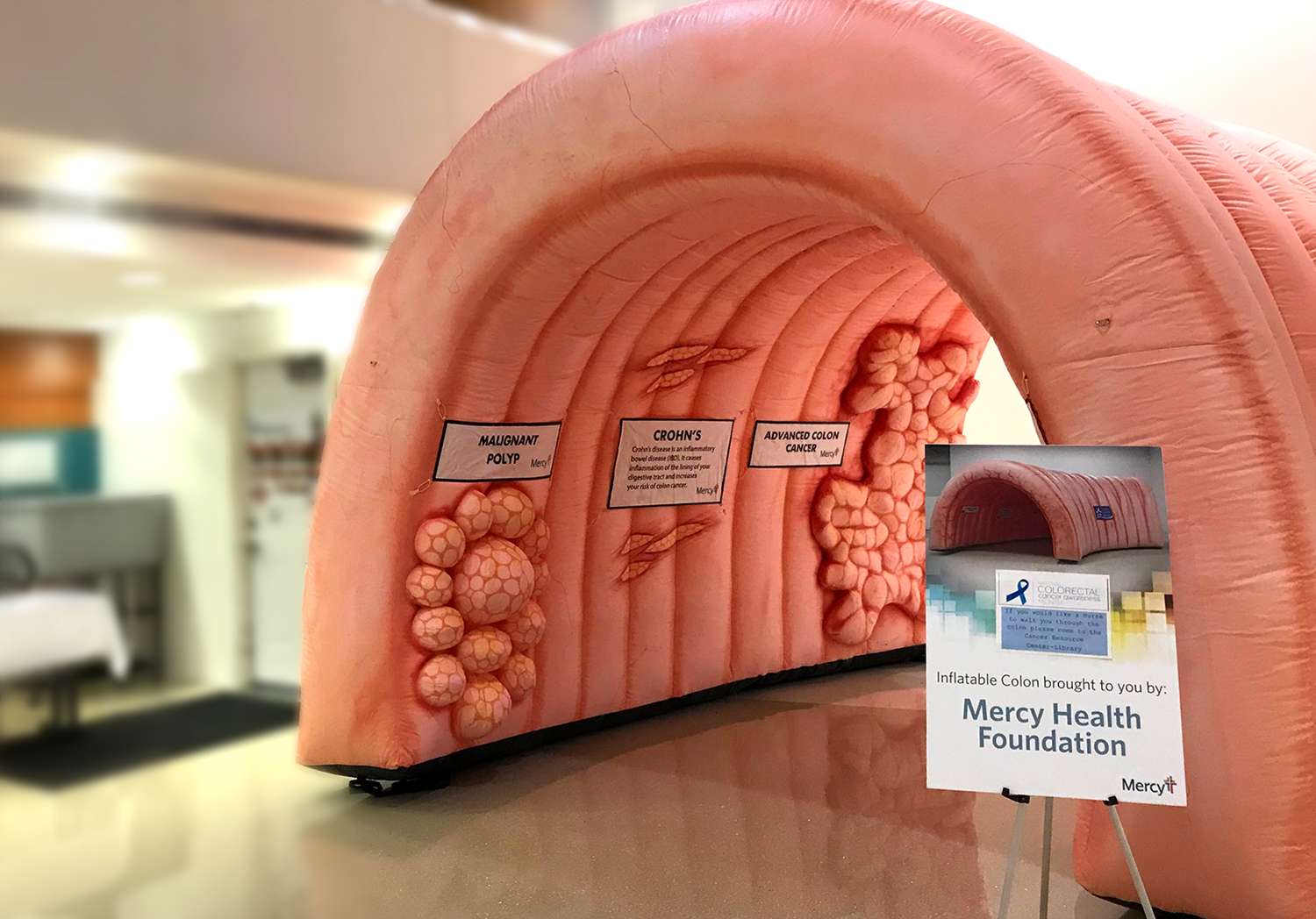 Giant Inflatable Colon Teaches About Colorectal Cancer Mercy